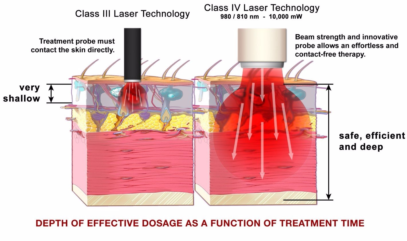 Infographic comparing class 4 laser therapy with low level laser therapy